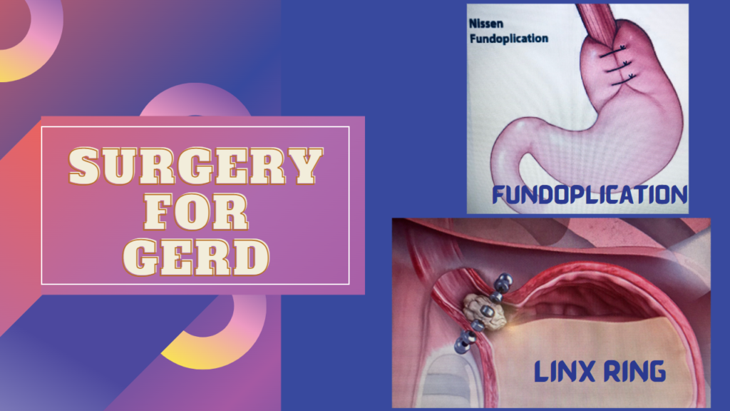 Surgical options for GERD