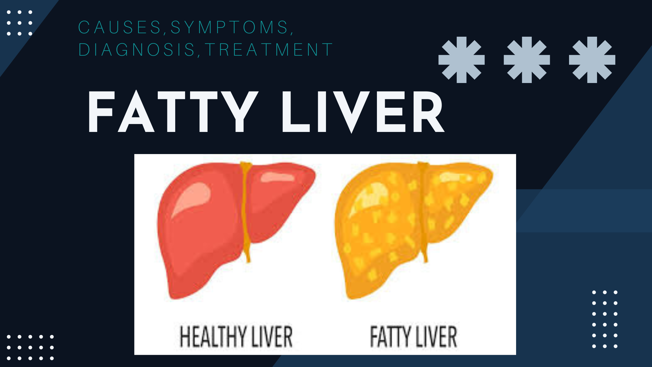 Fatty liver a common condition