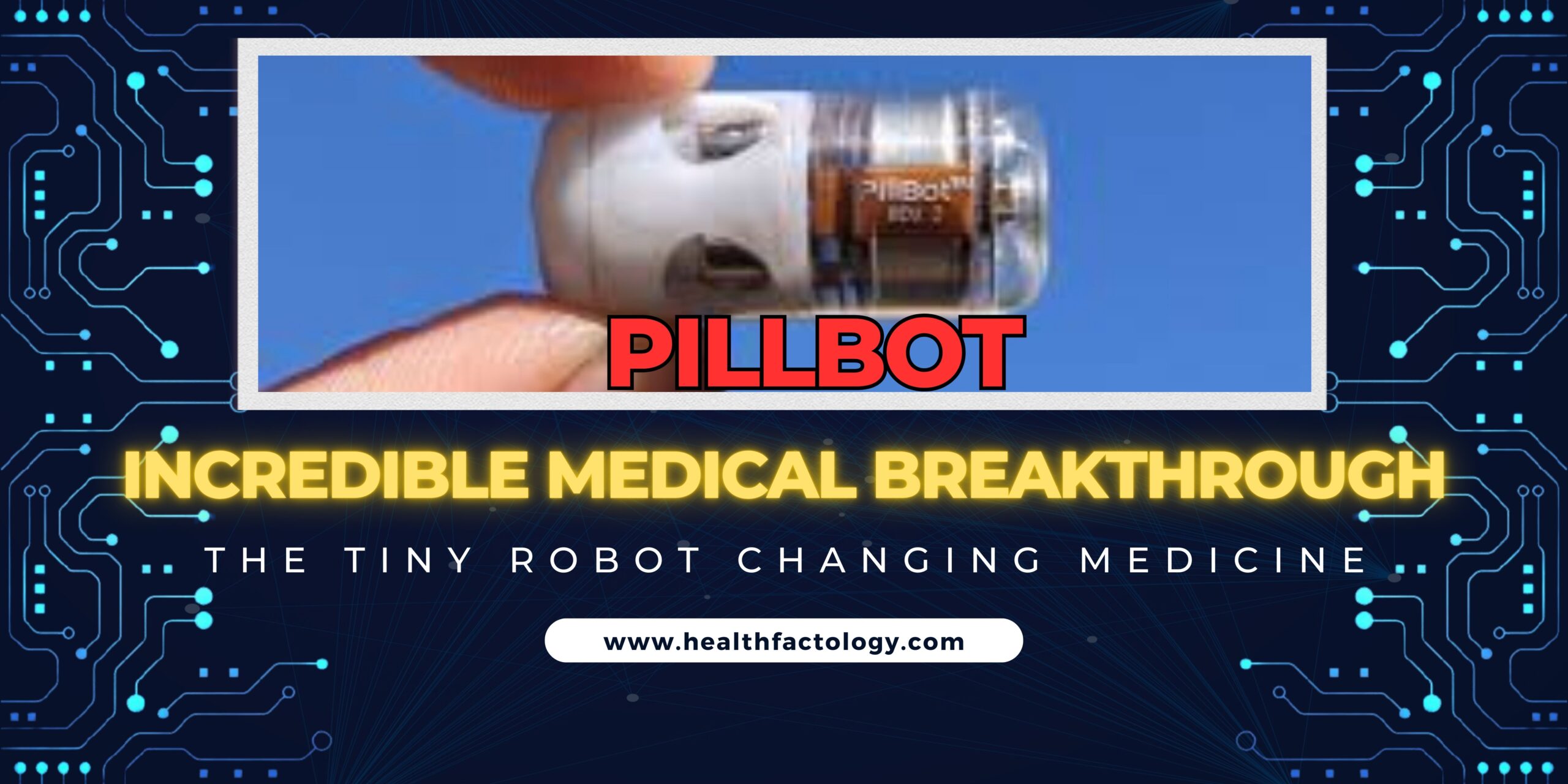 Pillbot micro robot a game changer in internal medicine diagnosis